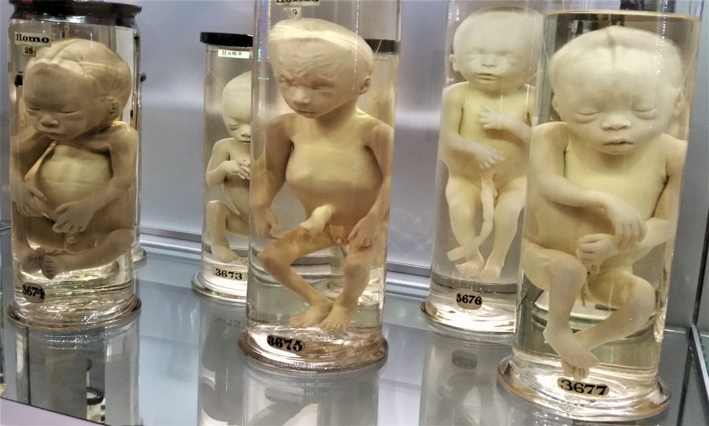 foetuses