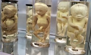 foetuses