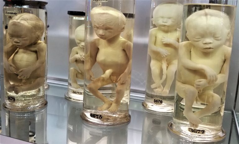 foetuses