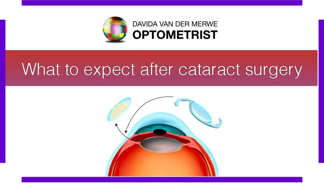 Davida van der Merwe Optometrist_Cataract Surgery Featured Image