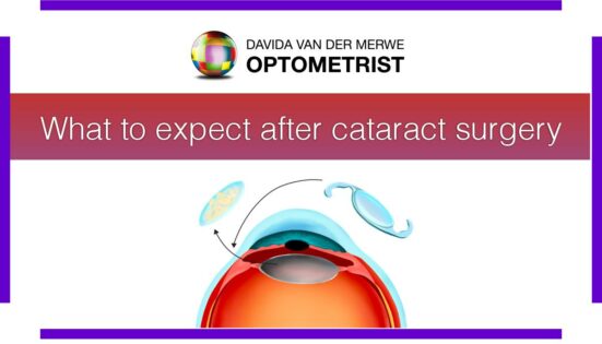 Davida van der Merwe Optometrist_Cataract Surgery Featured Image