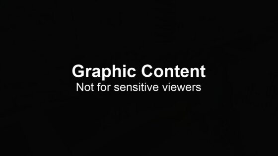 Graphic Content - Not for sensitive viewers