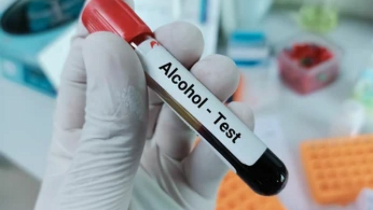 Alcohol Blood Test