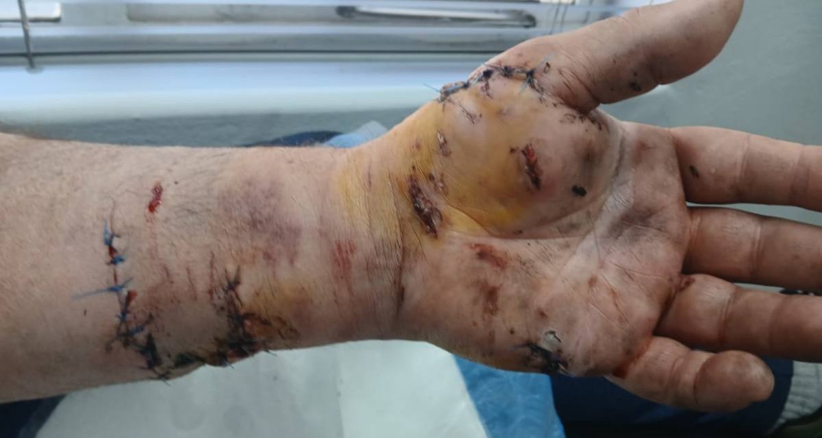 Newcastle dog attack Amiel Road