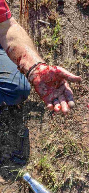 Newcastle dog attack Amiel Road