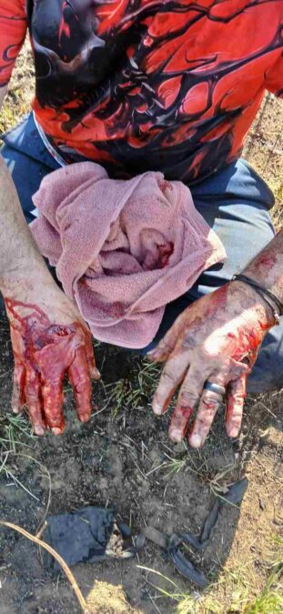 Newcastle dog attack Amiel Road